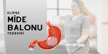 Mide Balonu Fiyatları
